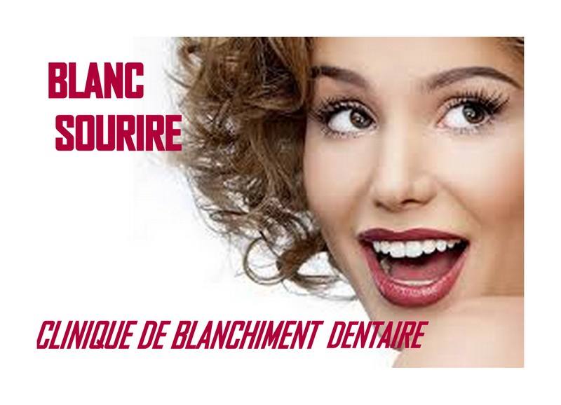 Clinique De Blanchiment Dentaire BLANC Sourire | 48 Chemin Bricault, Farnham, QC J2N 2P9, Canada | Phone: (450) 521-6601