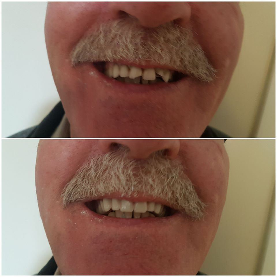 Sackville Denture Clinic - McCollum Mobile Denture Clinic | 131 Main St Suite C, Sackville, NB E4L 4B2, Canada | Phone: (506) 939-3111