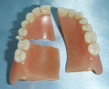 GEM Dentures | 2000 Credit Valley Rd #205, Mississauga, ON L5M 4N4, Canada | Phone: (905) 607-7389