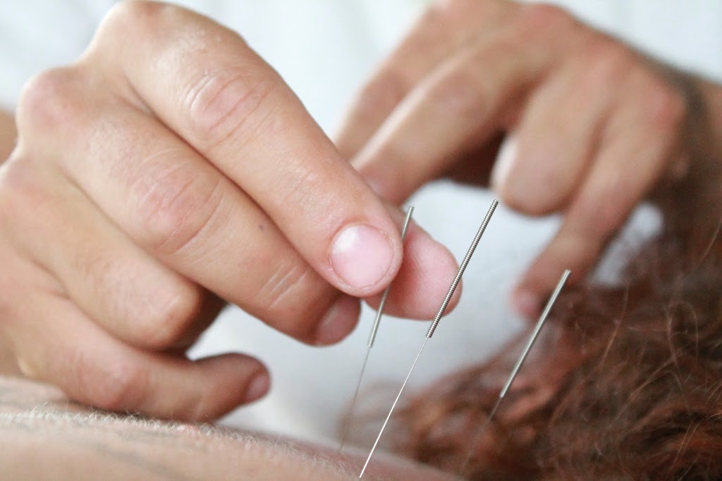 Acupuncture entre Ciel Et Terre | 695 Avenue de la Station #201, Shawinigan, QC G9N 1V9, Canada | Phone: (819) 244-4729