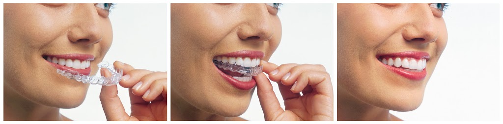 Westmount Dental | 8010 Bathurst St c4, Thornhill, ON L4J 0B8, Canada | Phone: (905) 881-8284