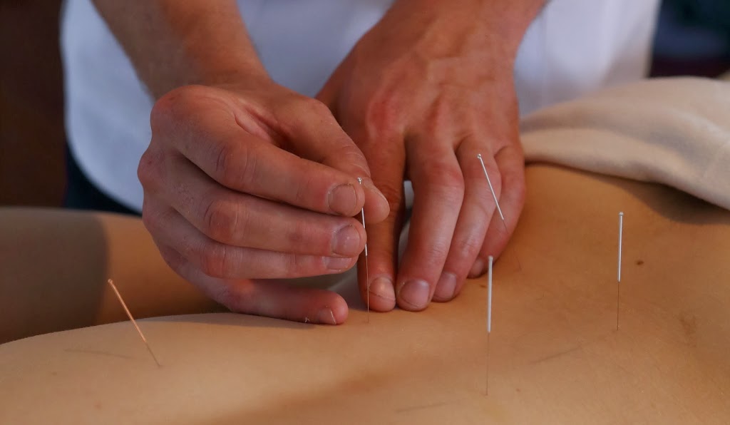 Dominic Ferland, Acupuncteur | 3871 Rue Nina, Laval, QC H7P 1E8, Canada | Phone: (514) 742-5534