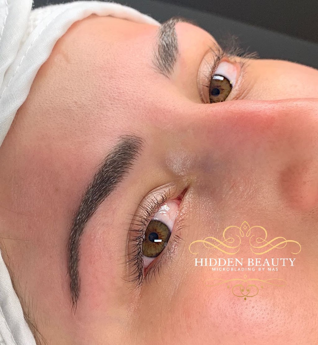 Hidden Beauty Medspa Corp | 1255 Ernest Ave, London, ON N6E 2B2, Canada | Phone: (226) 700-4839