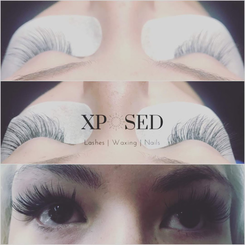 Xposed Esthetics | 529 Baycroft Dr, Martensville, SK S0K 2T2, Canada | Phone: (306) 203-4643