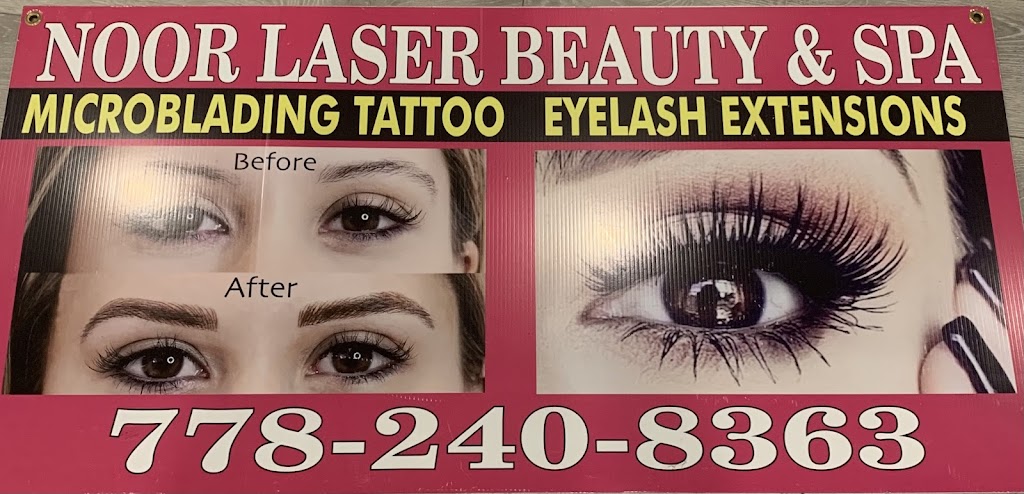 Noor Laser Beauty Salon | 12336 80 Ave, Surrey, BC V3W 3A2, Canada | Phone: (778) 240-8363