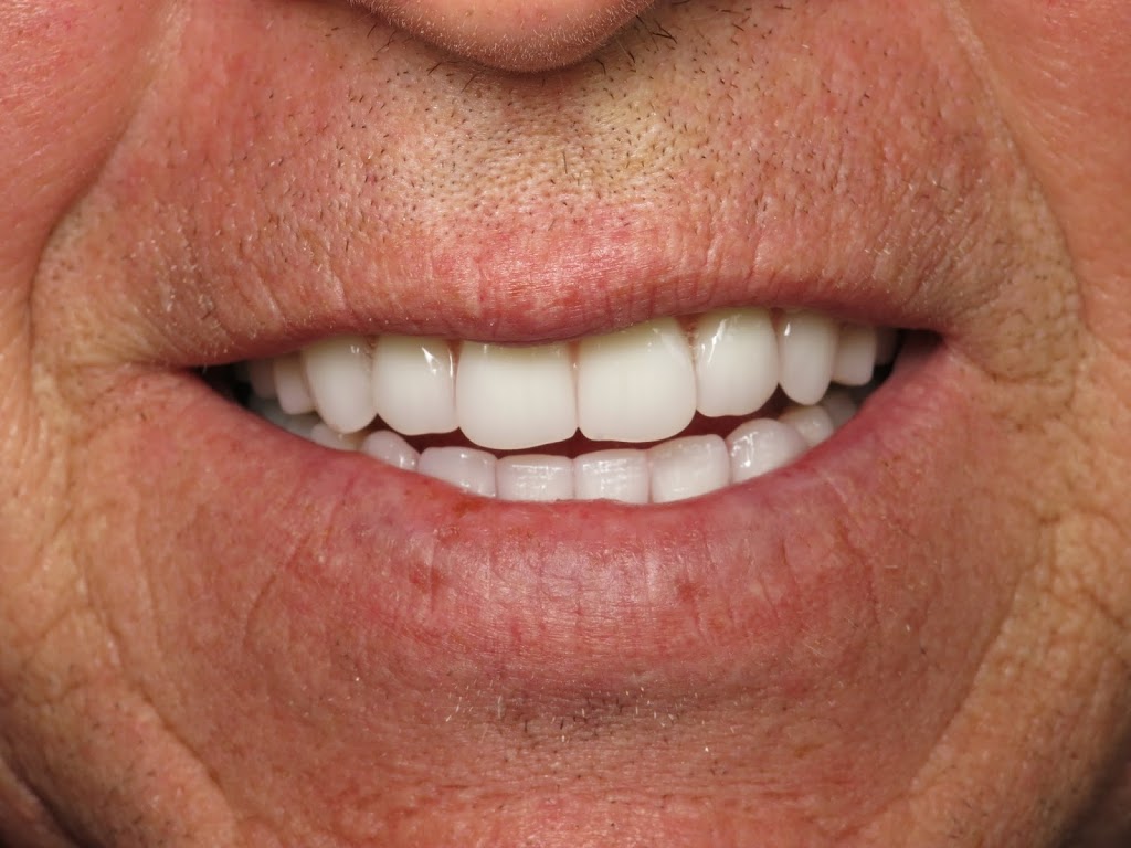 Westside Denture Centre | 1919 Sirocco Dr SW, Calgary, AB T3H 2Y3, Canada | Phone: (403) 242-5880