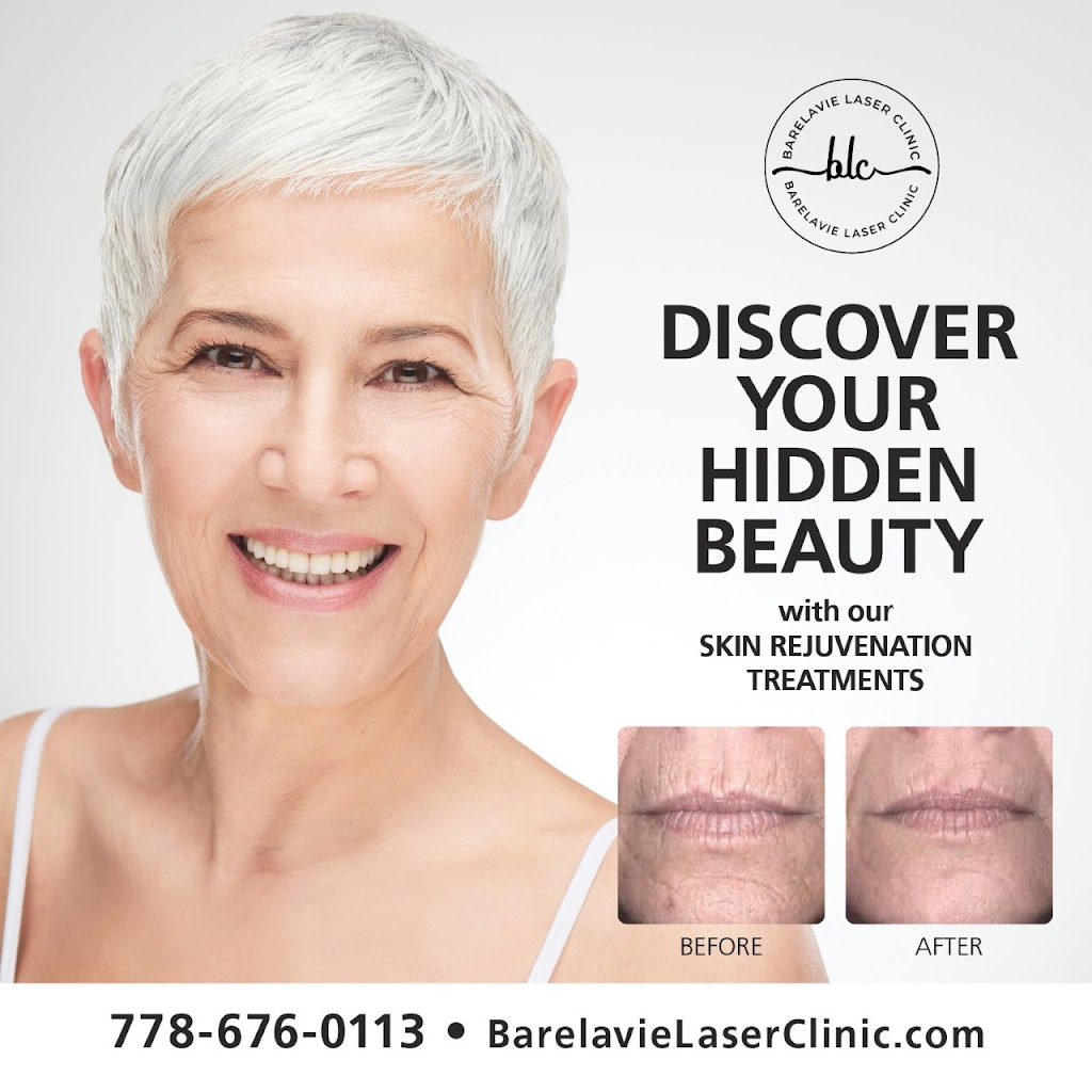 Barelavie Laser Clinic | 472 Regency Pl, Victoria, BC V9C 0J7, Canada | Phone: (778) 676-0113