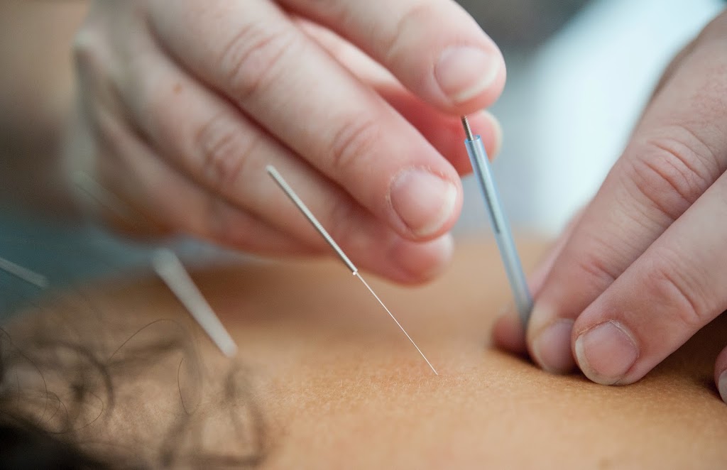 Acupuncture Johanne Mc Intyre | 858 Rue Shefford local 111, Bromont, QC J2L 1C3, Canada | Phone: (514) 222-5989