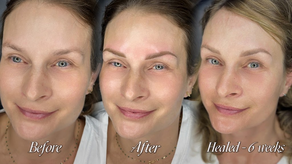 Forever Flawless Permanent Makeup Keswick | 514 The Queensway S, Keswick, ON L4P 2E4, Canada | Phone: (705) 888-9544