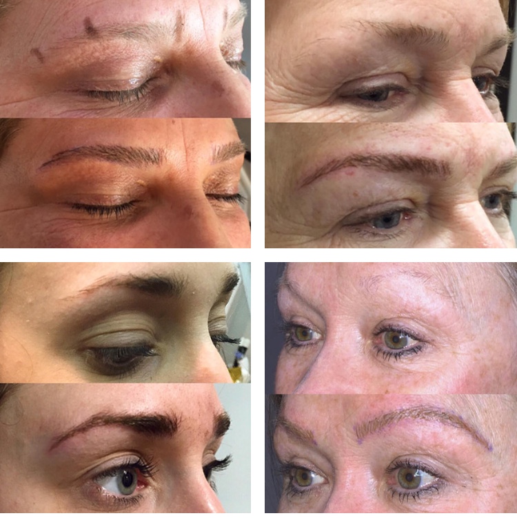 Mobile Microblading | 14 Grand Forest Dr, Barrie, ON L4N 7E7, Canada | Phone: (705) 252-1047