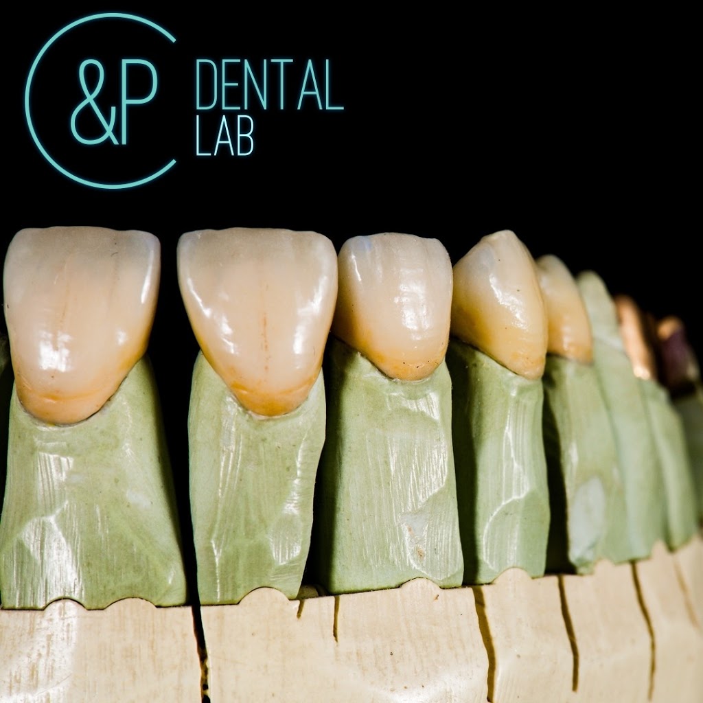 C & P Dental Lab | 535 Glengarry Ave, North York, ON M5M 1G2, Canada | Phone: (416) 782-8391