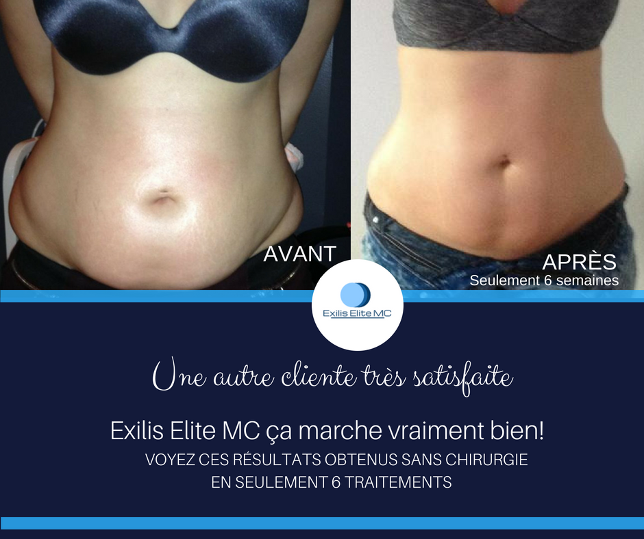 Concept Beauté MC | 2000 Rue des Patriotes bureau 5, Laval, QC H7L 2N8, Canada | Phone: (514) 546-0960