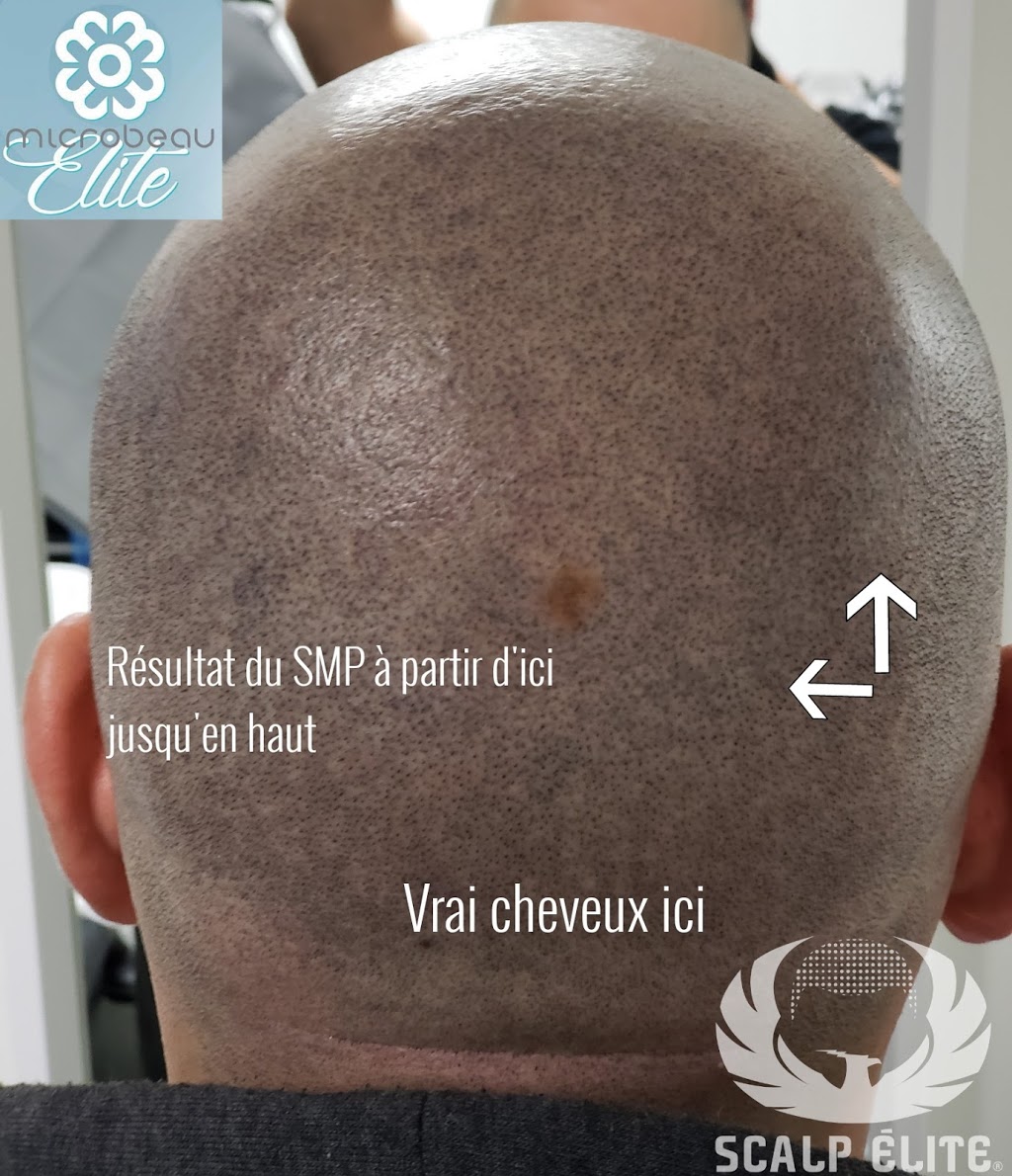 Clinical Scalp Élite© Certifiée | 2700 Boulevard des Entreprises #102, Terrebonne, QC J6X 4J8, Canada | Phone: (877) 439-5554