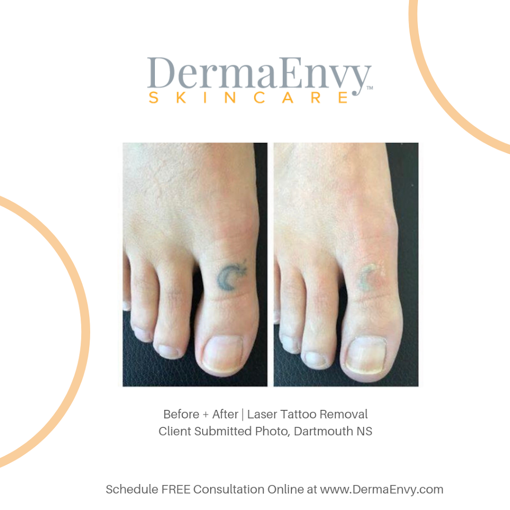 DermaEnvy Skincare - Waterloo | 99 Northfield Dr E Suite 305, Waterloo, ON N2K 3P9, Canada | Phone: (519) 888-8149