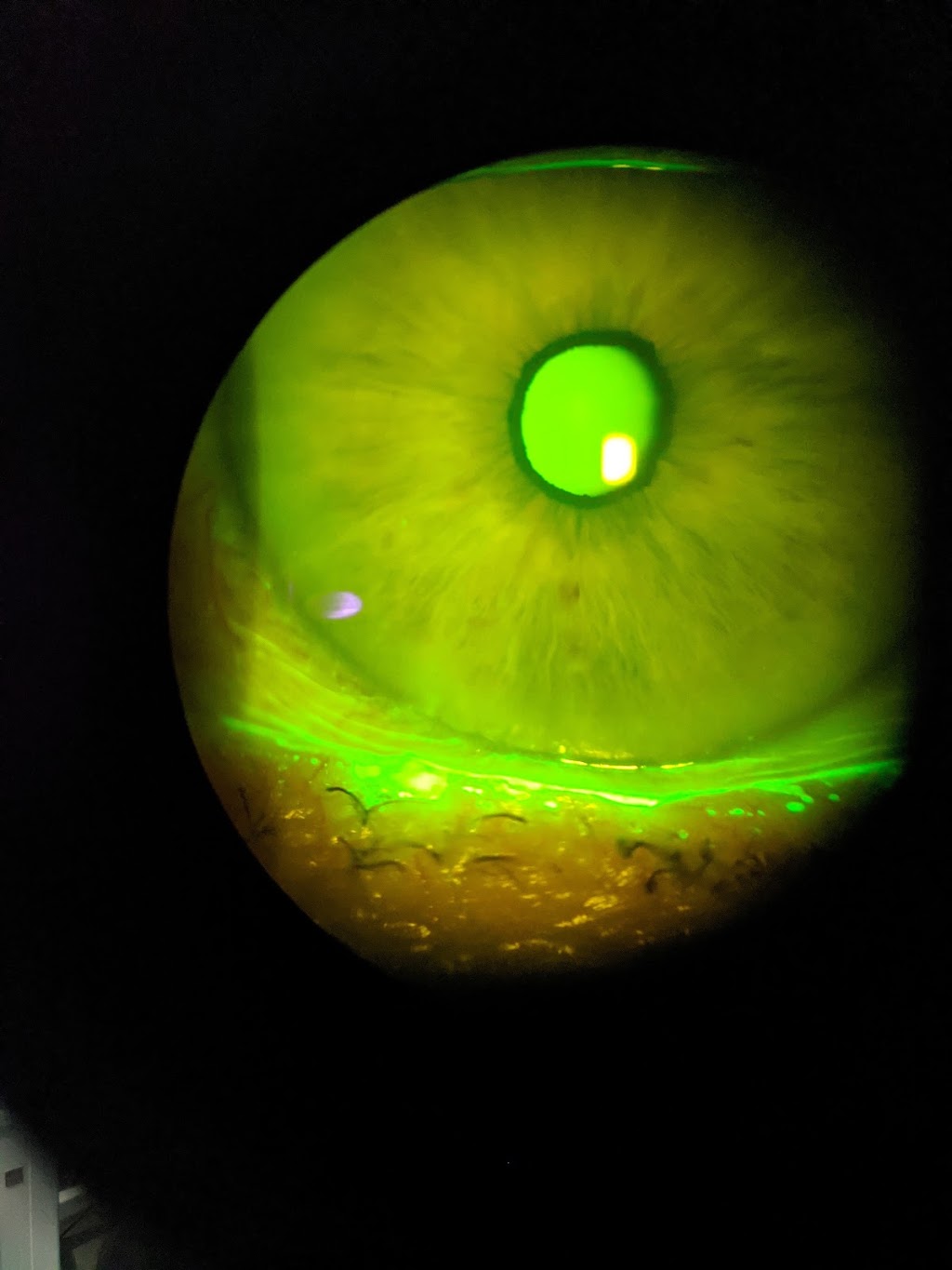 Prism Dry Eye Clinic (formerly eyeLABS Optometry) | 7700 Hurontario St #605, Brampton, ON L6Y 4M3, Canada | Phone: (905) 456-3937