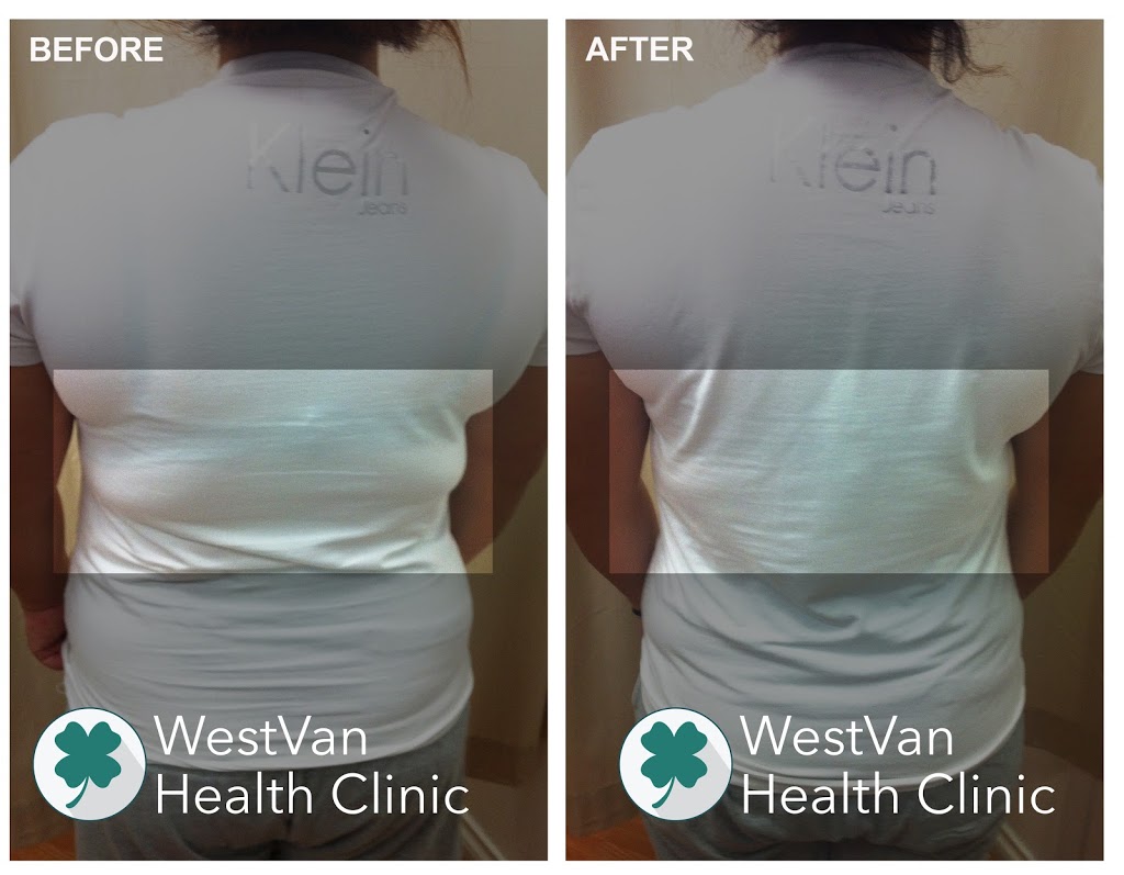 WestVan Health Clinic | 2419 Bellevue Ave #119, West Vancouver, BC V7V 4T4, Canada | Phone: (604) 922-8800