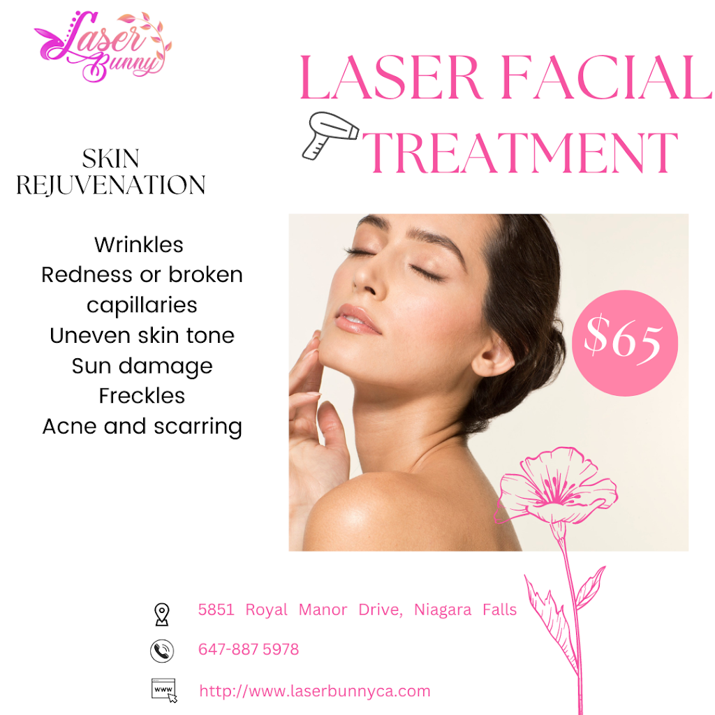 Laser Bunny | 5851 Royal Manor Dr, Niagara Falls, ON L2G 1W4, Canada | Phone: (647) 887-5978