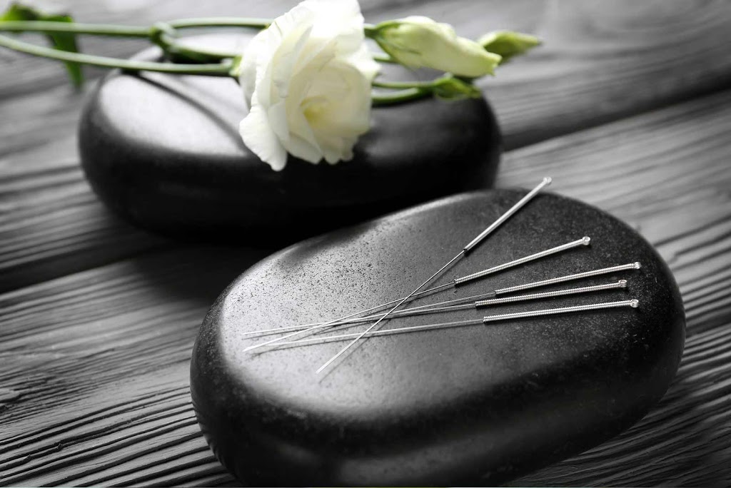 Marie Pier Vallée ACUPUNCTURE | 16847 Rue Charles, Mirabel, QC J7J 1L8, Canada | Phone: (514) 946-9264