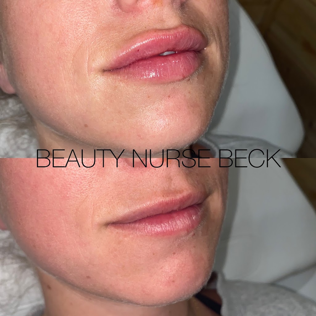 Beauty Nurse Beck - Seaforth | 39 Main St S, Seaforth, ON N0K 1W0, Canada | Phone: (226) 338-9202