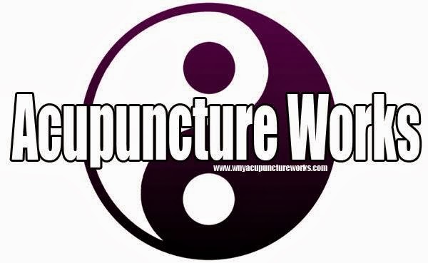 Acupuncture Works | 1961 Wehrle Dr #7, Williamsville, NY 14221, USA | Phone: (716) 276-8866