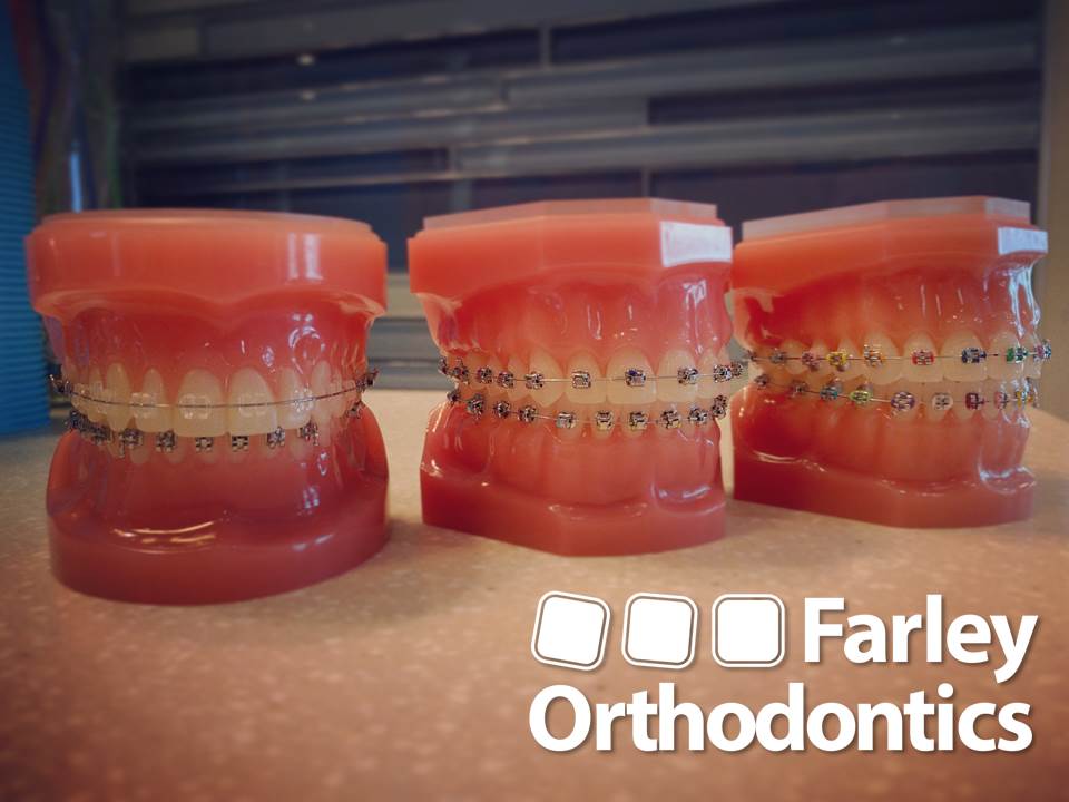 Farley Orthodontics | 3265 Niagara Falls Blvd, North Tonawanda, NY 14120, USA | Phone: (716) 692-9292