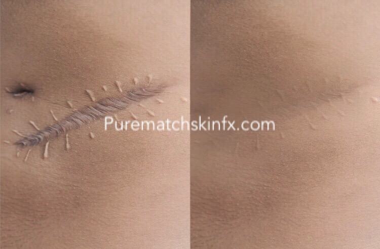 Pure Match Skin FX | 170 Shelbourne Dr, Woodbridge, ON L4H 0J6, Canada | Phone: (416) 899-7624