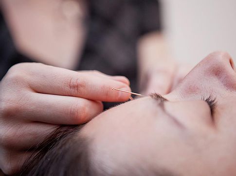 Acupuncture Renée-Lise Lavoie - Candiac | 70 Chem. Saint-François-Xavier, Candiac, QC J5R 4Z5, Canada | Phone: (450) 632-5777