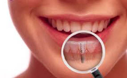 Dentiste Dr. Ouali Polyclinique Rosemont | 5345 Boulevard de lAssomption, Montréal, QC H1T 4B3, Canada | Phone: (514) 253-2348