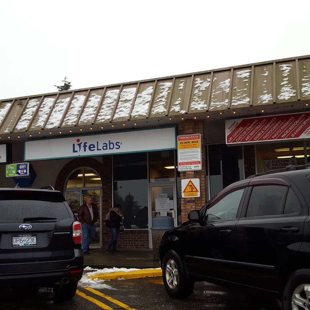 LifeLabs Medical Laboratory Services | 972 W King Edward Ave, Vancouver, BC V5Z 2E2, Canada | Phone: (604) 431-7206