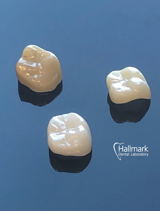 Hallmark Dental Laboratory Ltd | 224 Hobsons Lake Dr, Halifax, NS B3S 0G4, Canada | Phone: (902) 443-1211