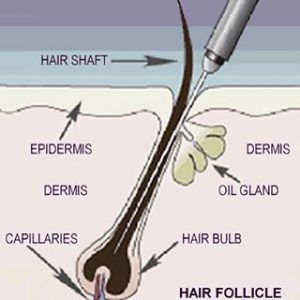 Waxing & Electrolysis | 10 Sheffield St, Dundalk, ON N0C 1B0, Canada | Phone: (416) 809-5224