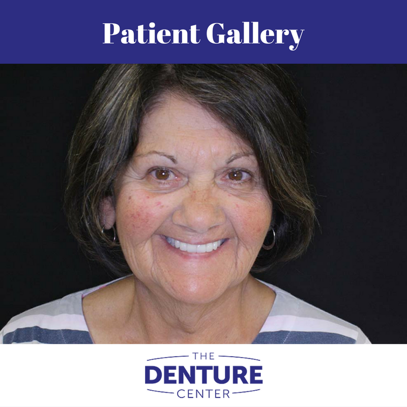 The Denture Center | 2892 S Sheridan Way, Oakville, ON L6J 7L4, Canada | Phone: (905) 829-1033