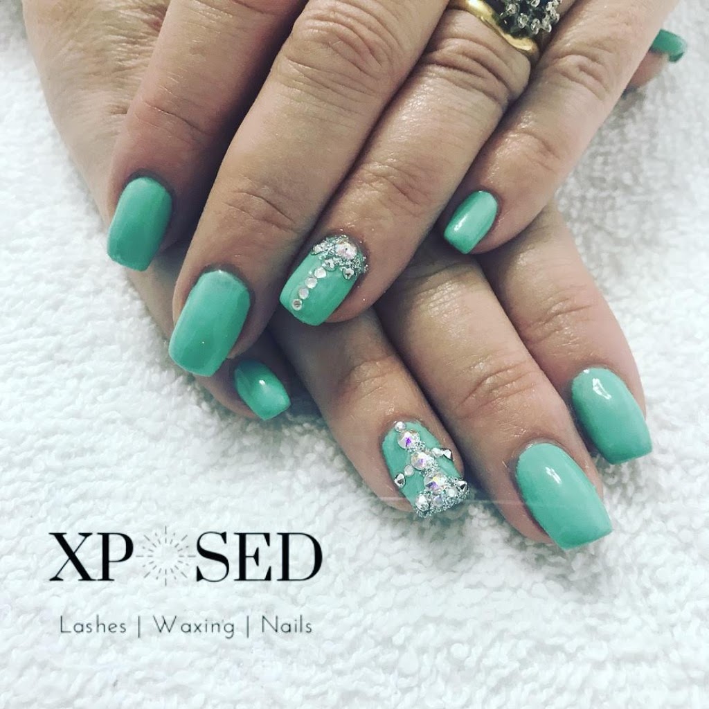 Xposed Esthetics | 529 Baycroft Dr, Martensville, SK S0K 2T2, Canada | Phone: (306) 203-4643