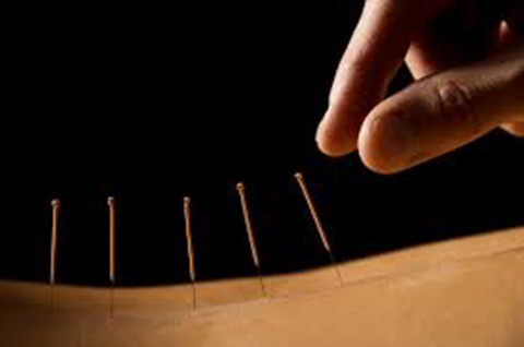 Acupuncture Audrey Valade | 450 Boulevard Brassard #204, Chambly, QC J3L 6K4, Canada | Phone: (450) 279-1112