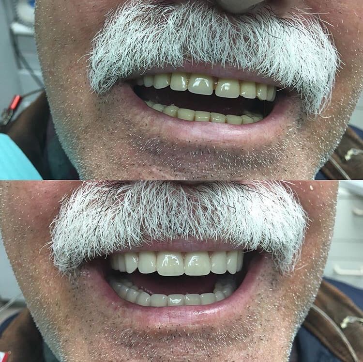 Great Smile Denture Clinic Inc | 566 Sheppard Ave W, North York, ON M3H 2R9, Canada | Phone: (416) 398-7846