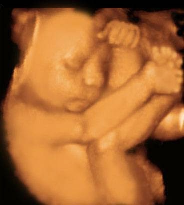 UC Baby 3D Ultrasound | 25 Watline Ave #21, Mississauga, ON L4Z 2Z1, Canada | Phone: (905) 615-0173