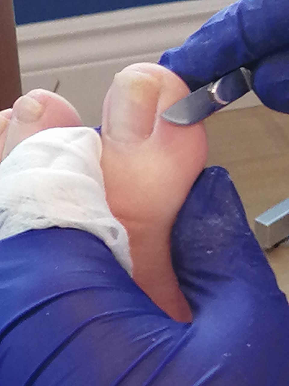 Clinique Professionnel La Santé des Pieds | 1695 Rue de Sorel, Granby, QC J2J 0K6, Canada | Phone: (579) 488-7670