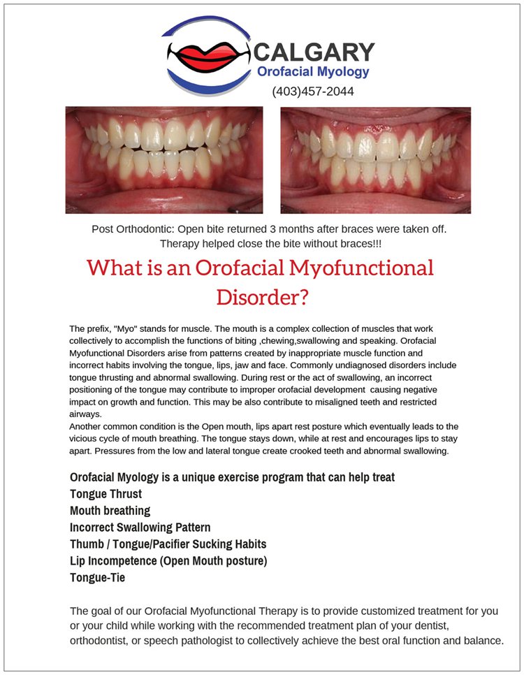 Calgary Orofacial Myology | c/o Shawn Ryer Lifetime Smiles Dental Hygiene Clinic Suite 204,, 11150 Bonaventure Dr SE, Calgary, AB T2J 6R9, Canada | Phone: (403) 457-2044