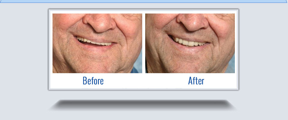 Waterdown Denture and Implant Clinic | 245 Dundas St E #3, Waterdown, ON L8B 0E9, Canada | Phone: (905) 690-0222