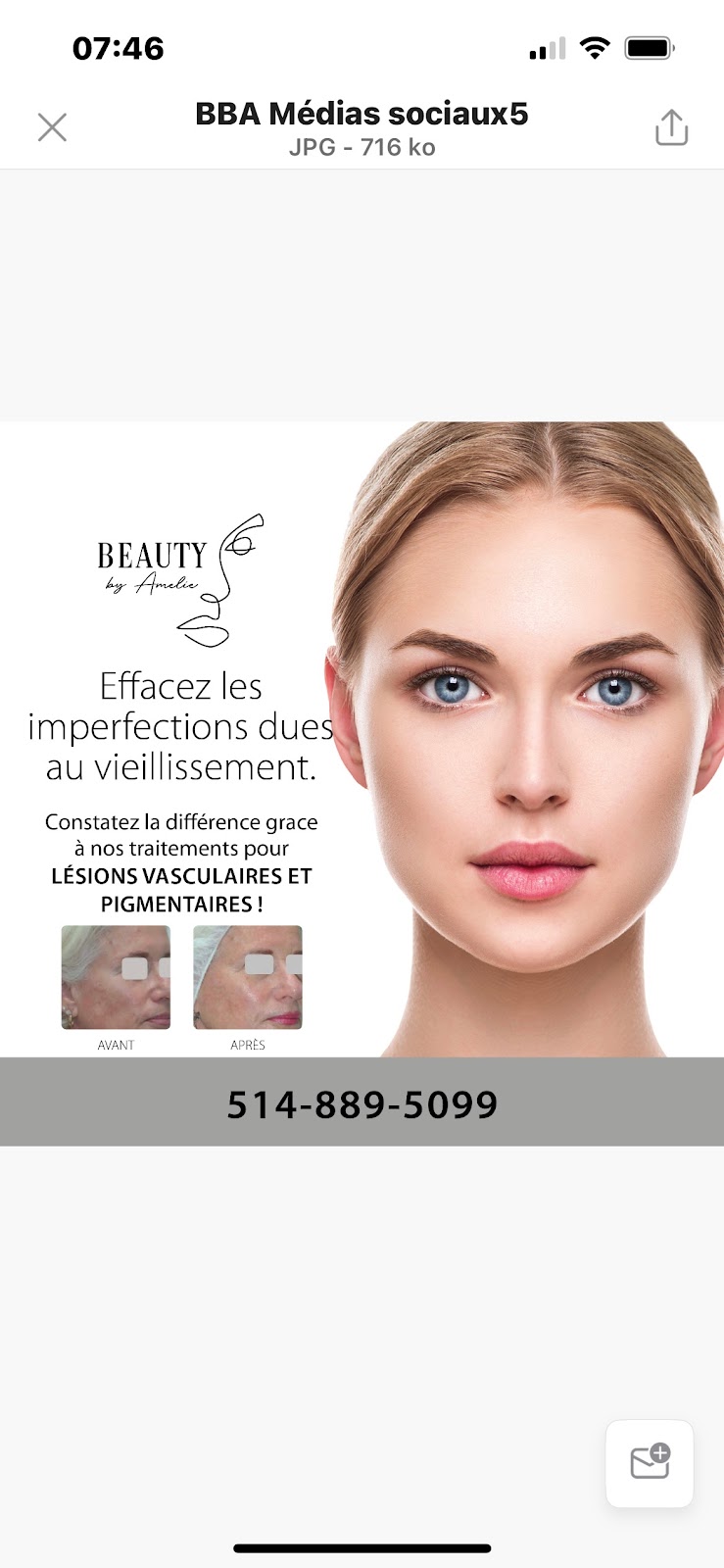 Beauty By Amelie Laser & Esthétique | Rue Victor, Mirabel, QC J7J 1B4, Canada | Phone: (514) 889-5099