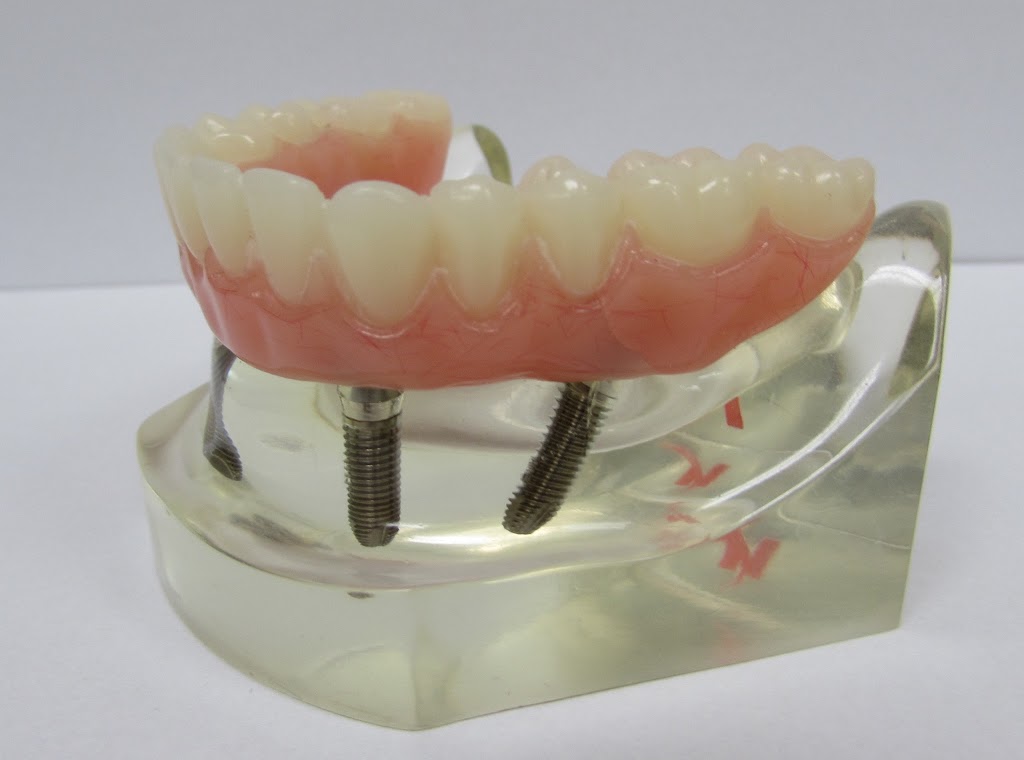 Southwest Denture Centre | 316 Windermere Rd NW #304, Edmonton, AB T6W 2P2, Canada | Phone: (780) 988-2257