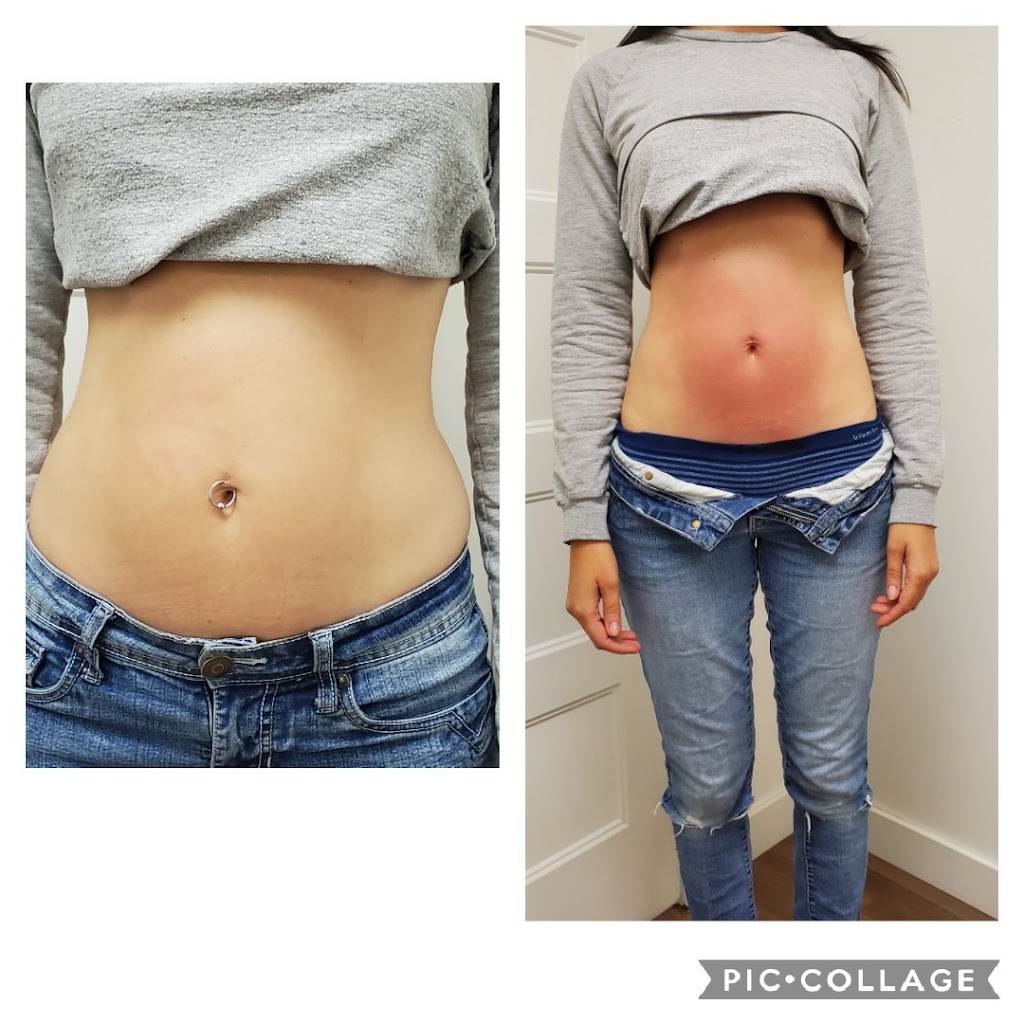 LUrbain Esthétique et Laser Trois-Rivières | 1650 Rue Dumoulin, Trois-Rivières, QC G8Z 2B3, Canada | Phone: (819) 477-2468