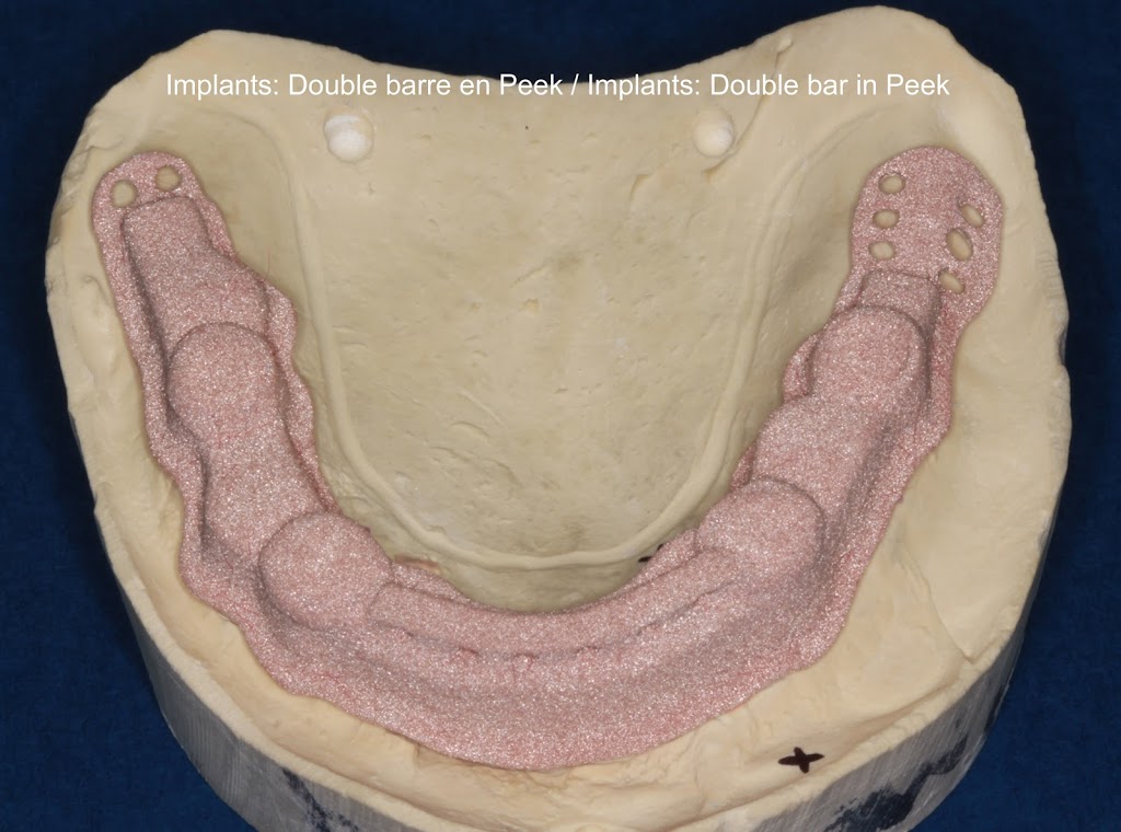 Dentoflex inc. Laboratoire dentaire | 871 Rue Mélanie, Laval, QC H7X 3V3, Canada | Phone: (450) 969-0148