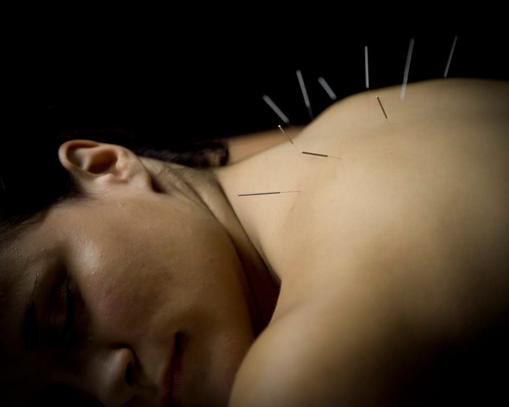 AJM Acupuncture | 11812 St Albert Trail NW, Edmonton, AB T5L 4G4, Canada | Phone: (780) 488-2789