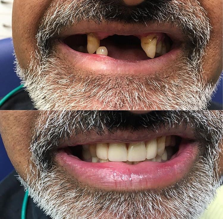 Great Smile Denture Clinic Inc | 566 Sheppard Ave W, North York, ON M3H 2R9, Canada | Phone: (416) 398-7846