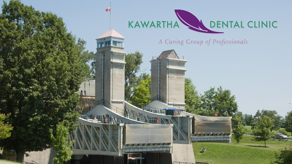 Kawartha Dental Clinic | 250 Reid St, Peterborough, ON K9J 3R1, Canada | Phone: (705) 743-1851