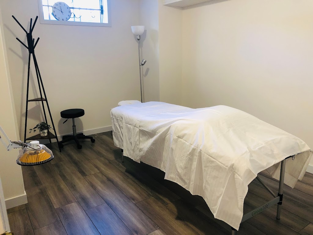 Classic acupuncture | 16 Edgeridge Way NW, Calgary, AB T3A 4G8, Canada | Phone: (647) 861-0238