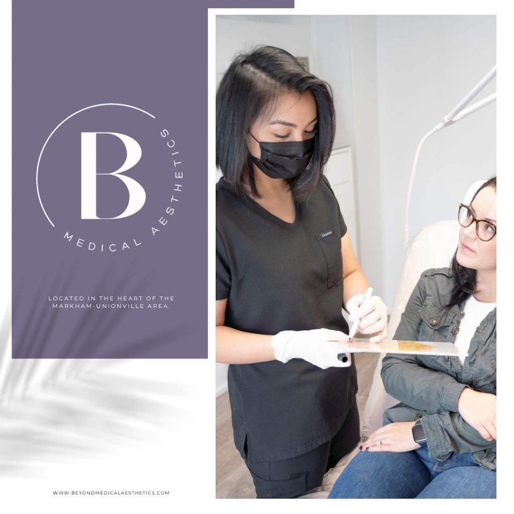 Beyond Medical Aesthetics | 23 Woodglen Way, Unionville, ON L3R 3A7, Canada | Phone: (647) 998-0225