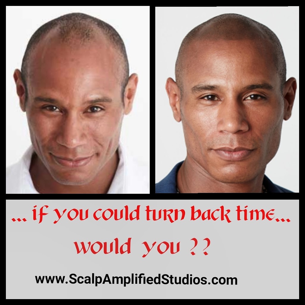 Scalp Amplified Studios | 987 King St E Unit 205, Hamilton, ON L8M 1C6, Canada | Phone: (905) 929-9250