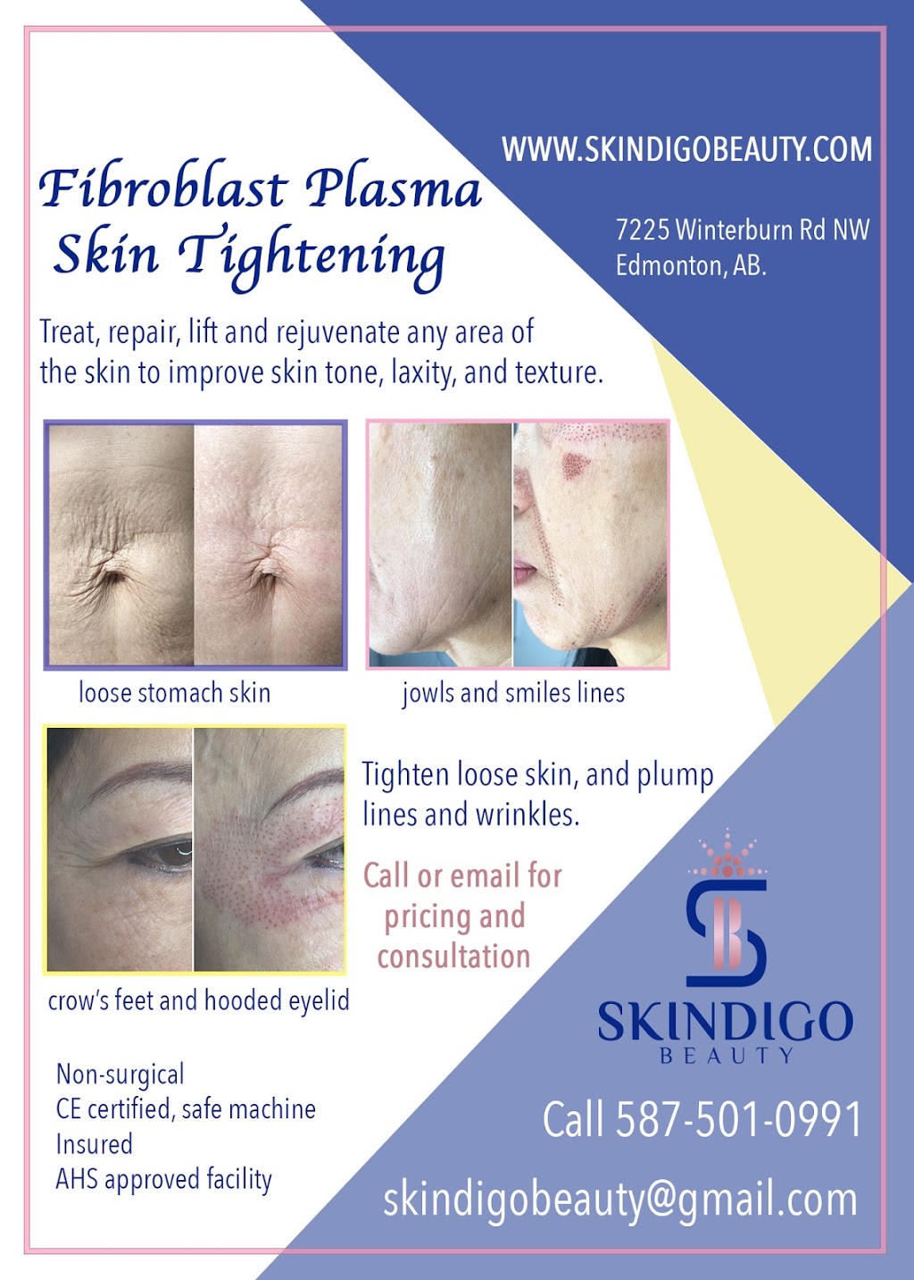 Skindigo Beauty | 7225 Winterburn Rd NW, Edmonton, AB T5T 4K2, Canada | Phone: (587) 501-0991